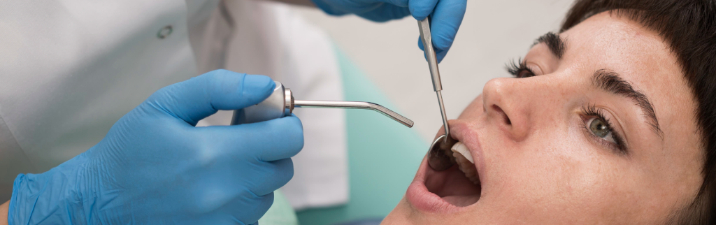 ¿Cada cuánto hay que hacerse una limpieza dental profesional? Aunque el cepillado diario es fundamental para mantener una buena higiene oral, no siempre consigue eliminar toda la placa bacteriana y el sarro que se acumula con el tiempo. Las limpiezas dentales ayudan a prevenir caries, gingivitis y otros problemas bucodentales. Descubre cuándo recomiendan los dentistas realizar una limpieza dental y por qué es tan importante para tu salud bucal…